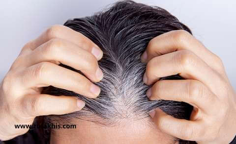 Castor Oil For Reversing Grey Hair 44
